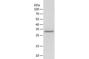 Western Blotting (WB) image for Y Box Binding Protein 1 (YBX1) (AA 1-324) protein (His tag) (ABIN7125753)