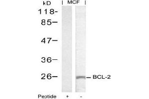 Image no. 2 for anti-B-Cell CLL/lymphoma 2 (BCL2) (Ser70) antibody (ABIN197204) (Bcl-2 anticorps  (Ser70))