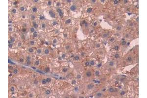 IHC-P analysis of Human Liver Tissue, with DAB staining. (SIGIRR anticorps  (AA 1-118))