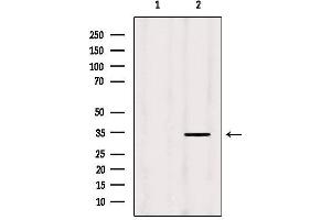 Western blot analysis of extracts from Hela, using MRPL19 Antibody. (MRPL19 anticorps  (Internal Region))