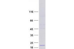 Ubiquitously-Expressed, Prefoldin-Like Chaperone (UXT) (Transcript Variant 2) protein (Myc-DYKDDDDK Tag)
