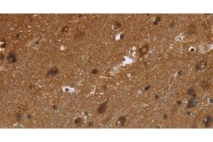 Immunohistochemistry of paraffin-embedded Human brain using FRK Polyclonal Antibody at dilution of 1:50 (FRK anticorps)