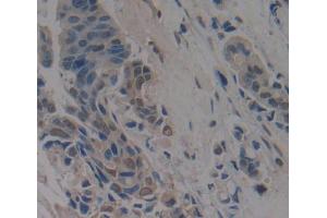 Used in DAB staining on fromalin fixed paraffin- embedded breast cancer tissue (Anoctamin 2 anticorps  (AA 823-1003))