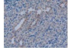 Detection of AQP4 in Rat Kidney Tissue using Polyclonal Antibody to Aquaporin 4 (AQP4) (Aquaporin 4 anticorps  (AA 179-314))