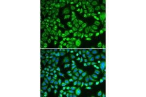 Immunofluorescence analysis of MCF-7 cells using PSMD7 antibody. (PSMD7 anticorps  (AA 1-324))