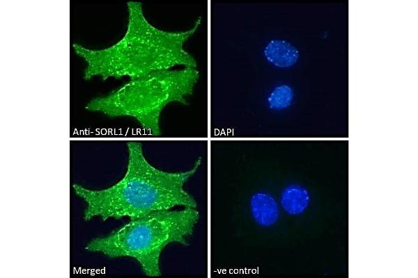 SORL1 anticorps  (C-Term)