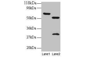 Western blot All lanes: ZNF384 antibody at 2 μg/mL Lane 1: EC109 whole cell lysate Lane 2: 293T whole cell lysate Secondary Goat polyclonal to rabbit IgG at 1/15000 dilution Predicted band size: 64, 57, 51 kDa Observed band size: 64, 51, 30 kDa (ZNF384 anticorps  (AA 1-245))