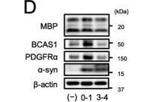 α-Syn PFF exposure to immature OLGs during differentiation-induced abnormal oligodendrogenesis. (BCAS1 anticorps  (AA 542-584))