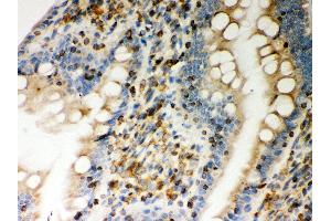 Anti- STIM1 Picoband antibody, IHC(P) IHC(P): Rat Intestine Tissue (STIM1 anticorps  (N-Term))