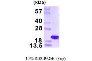 SDS-PAGE (SDS) image for N(alpha)-Acetyltransferase 50, NatE Catalytic Subunit (NAA50) (AA 1-169) protein (His tag) (ABIN667671) (NAA50 Protein (AA 1-169) (His tag))
