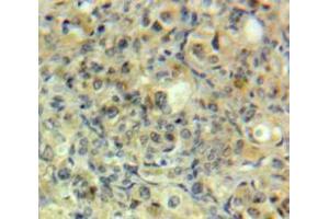 Used in DAB staining on fromalin fixed paraffin-embedded Ovary tissue
