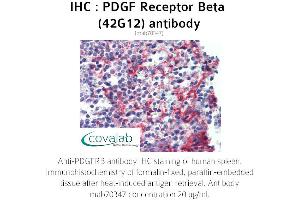 Image no. 1 for anti-Platelet Derived Growth Factor Receptor beta (PDGFRB) antibody (ABIN1723257)