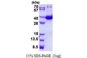 Figure annotation denotes ug of protein loaded and % gel used. (Galectin 9 Protéine)