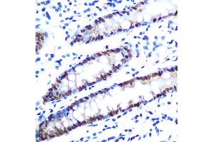 Immunohistochemistry of paraffin-embedded human colon using hnRNP  Rabbit mAb (1564) at dilution of 1:100 (40x lens).