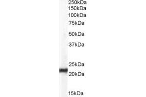 Western Blotting (WB) image for anti-Chromosome 15 Open Reading Frame 26 (C15orf26) (Middle Region) antibody (ABIN2785319) (C15orf26/CFAP161 anticorps  (Middle Region))