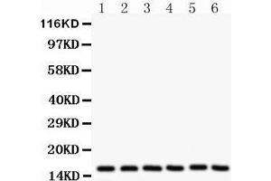 Western Blotting (WB) image for anti-Superoxide Dismutase 1, Soluble (SOD1) (AA 116-146), (C-Term) antibody (ABIN3043438) (SOD1 anticorps  (C-Term))