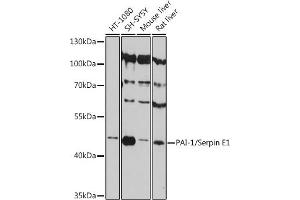 Western blot analysis of extracts of various cell lines, using PAI-1/Serpin E1 antibody (ABIN6131329, ABIN6147600, ABIN6147602 and ABIN6215676) at 1:3000 dilution. (PAI1 anticorps  (AA 24-158))