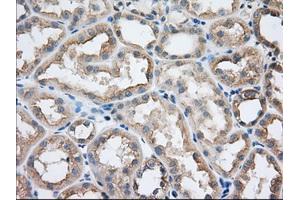 Immunohistochemistry (IHC) image for anti-Sorting Nexin 9 (SNX9) antibody (ABIN1501047)