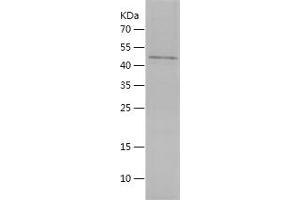 Western Blotting (WB) image for Hepatocyte Growth Factor (Hepapoietin A, Scatter Factor) (HGF) (AA 493-721) protein (His-IF2DI Tag) (ABIN7123304)