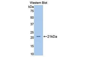 Western Blotting (WB) image for anti-Fibulin 1 (FBLN1) (AA 347-521) antibody (ABIN1175708)
