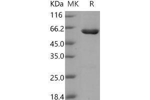 Western Blotting (WB) image for Casein Kinase 2, alpha Prime Polypeptide (CSNK2A2) (Active) protein (GST tag,His tag) (ABIN7317080)