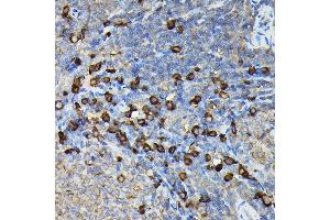 Immunohistochemistry of paraffin-embedded rat spleen using FA Rabbit pAb (ABIN7267102) at dilution of 1:100 (40x lens). (FAM117A anticorps)