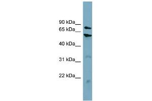 WB Suggested Anti-CPT1B Antibody Titration:  0. (CPT1B anticorps  (Middle Region))