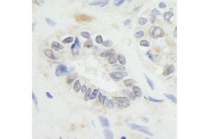 Immunohistochemistry (IHC) image for anti-Ring Finger Protein 20 (RNF20) (AA 125-175) antibody (ABIN7448779) (RNF20 anticorps  (AA 125-175))