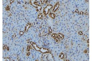 ABIN6272870 at 1/100 staining Mouse kidney tissue by IHC-P. (IFT140 anticorps  (Internal Region))
