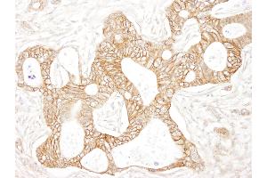 Immunohistochemistry (IHC) image for anti-Catenin, beta (CATNB) (AA 760-781) antibody (ABIN7448432)