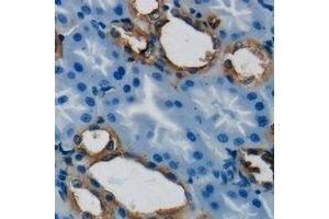 Immunohistochemical analysis of GSTT1 staining in human kidney formalin fixed paraffin embedded tissue section. (GSTT1 anticorps)