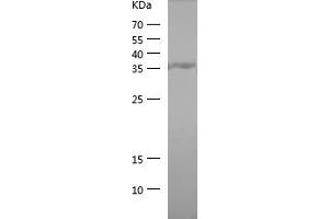 Western Blotting (WB) image for Protein tyrosine Phosphatase, Non-Receptor Type 1 (PTPN1) (AA 268-406) protein (His tag) (ABIN7124680)