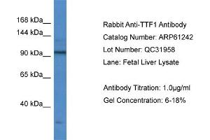 Western Blotting (WB) image for anti-Transcription Termination Factor, RNA Polymerase I (TTF1) (Middle Region) antibody (ABIN2788733) (TTF1 anticorps  (Middle Region))