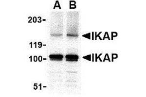 Western blot analysis of IKAP in A-20 cell lysate with AP30402PU-N IKAP antibody at in (A) 0. (IKAP/p150 anticorps  (C-Term))