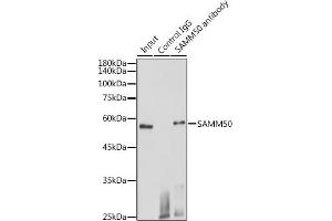 Immunoprecipitation analysis of 600 μg extracts of Mouse heart cells using 3 μg S antibody (ABIN1682619, ABIN3017779, ABIN3017780 and ABIN6220246).