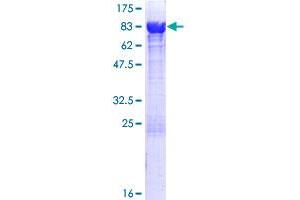 Image no. 1 for 5-Aminoimidazole-4-Carboxamide Ribonucleotide Formyltransferase/IMP Cyclohydrolase (ATIC) (AA 1-592) protein (GST tag) (ABIN1345986)