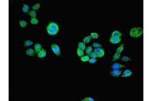 Immunofluorescent analysis of PC-3 cells using ABIN7166648 at dilution of 1:100 and Alexa Fluor 488-congugated AffiniPure Goat Anti-Rabbit IgG(H+L) (ACOT6 anticorps  (AA 1-207))