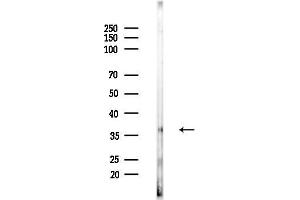 Western blot analysis of lysates from EC304 cells, using PTGER3 Antibody at 1/1000 dilution.