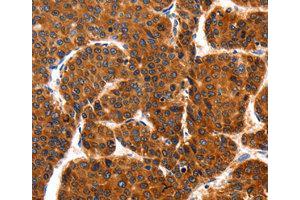 Immunohistochemistry (IHC) image for anti-TNF Receptor-Associated Protein 1 (TRAP1) antibody (ABIN1875197) (TRAP1 anticorps)
