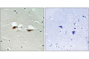 Immunohistochemistry analysis of paraffin-embedded human brain, using ATF-2 (Phospho-Ser472) Antibody. (ATF2 anticorps  (pSer472))