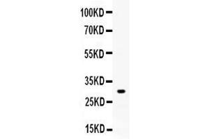 Western blot analysis of ZWINT expression in rat skeletal muscle extract ( Lane 1). (ZWINT anticorps  (AA 29-249))