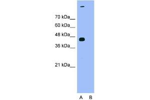 Host:  Rabbit  Target Name:  TARDBP  Sample Type:  HepG2  Lane A:  Primary Antibody  Lane B:  Primary Antibody + Blocking Peptide  Primary Antibody Concentration:  1.