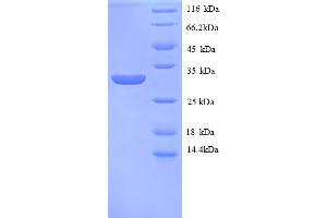 SDS-PAGE (SDS) image for Metallothionein 1E (MT1E) (AA 4-59), (partial) protein (GST tag) (ABIN4974715) (MT1E Protein (AA 4-59, partial) (GST tag))