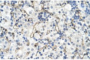Human Liver (SLC39A5 anticorps  (N-Term))