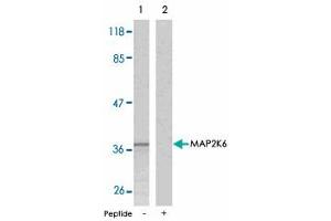 Western blot analysis of extracts from MDA-MB-435 cells using MAP2K6 polyclonal antibody . (MAP2K6 anticorps  (Ser207))