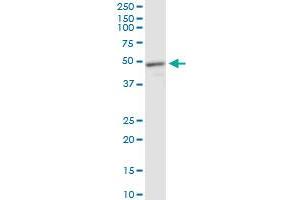 MECP2 monoclonal antibody (M01), clone 4B6. (MECP2 anticorps  (AA 81-170))