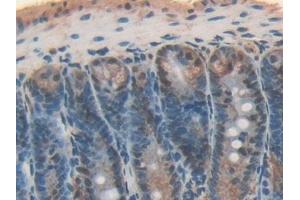 anti-Interleukin 17 Receptor D (IL17RD) (AA 356-605) antibody