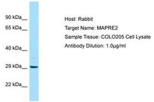 Image no. 1 for anti-Microtubule-Associated Protein, RP/EB Family, Member 2 (MAPRE2) (AA 157-206) antibody (ABIN6750058) (MAPRE2 anticorps  (AA 157-206))