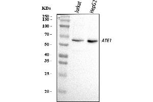 Western blot analysis of ATE1 using anti-ATE1 antibody (ABIN7602042).