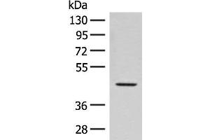 Western blot analysis of Hela cell lysate using FAM50A Polyclonal Antibody at dilution of 1:300 (FAM50A anticorps)